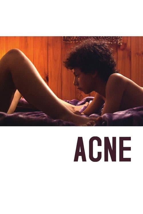 Póster de Acné