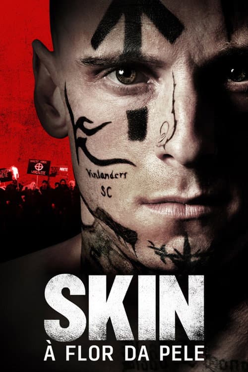 Affiche de Skin